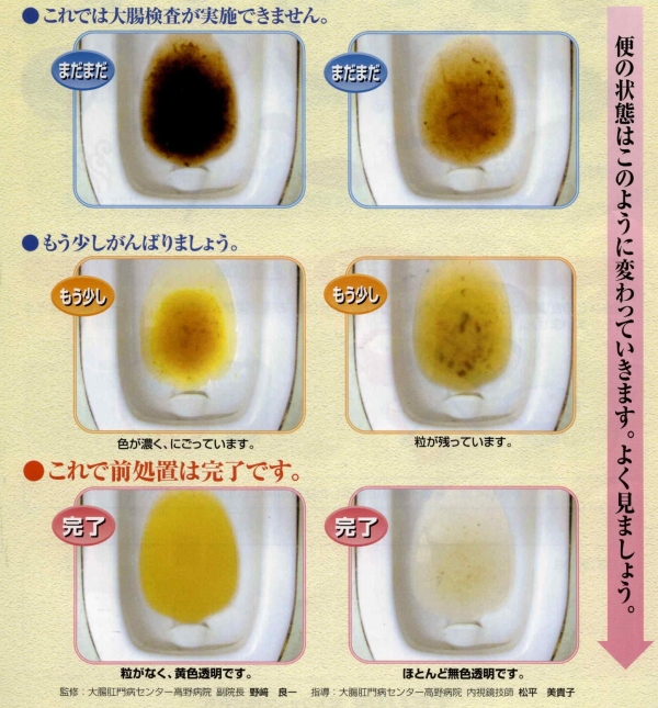 後 メニュー 鏡 内 視 検査 大腸 食事