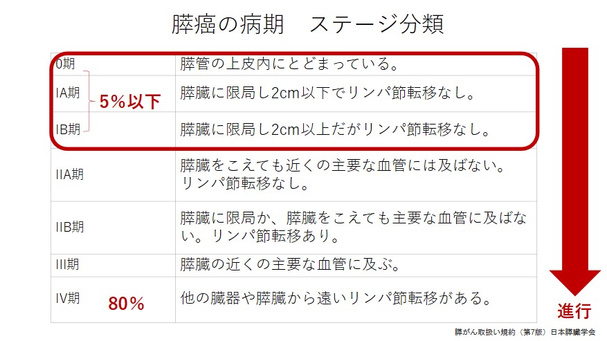 膵癌の病期　ステージ分類