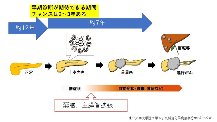 膵癌早期発見