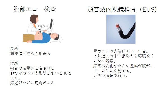 腹部エコー検査、超音波内視鏡検査