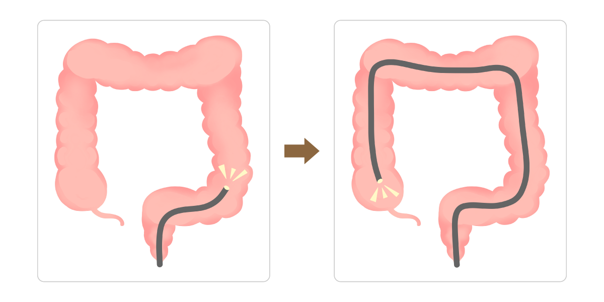 胃の不調の様子