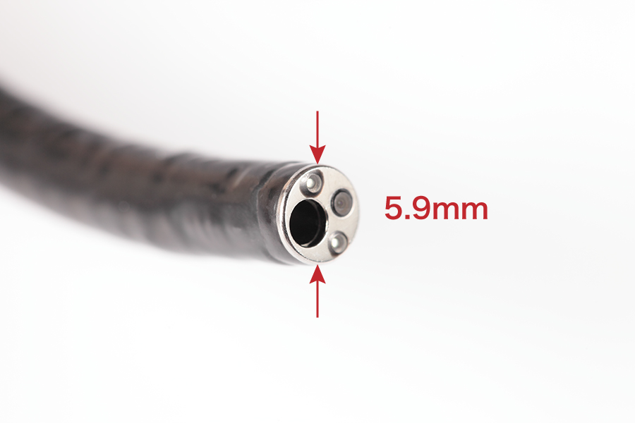 胃カメラ検査の「極細スコープ」