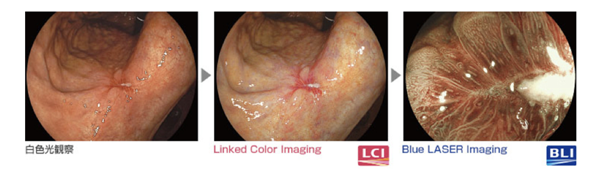 LEDシステムによる画像処理