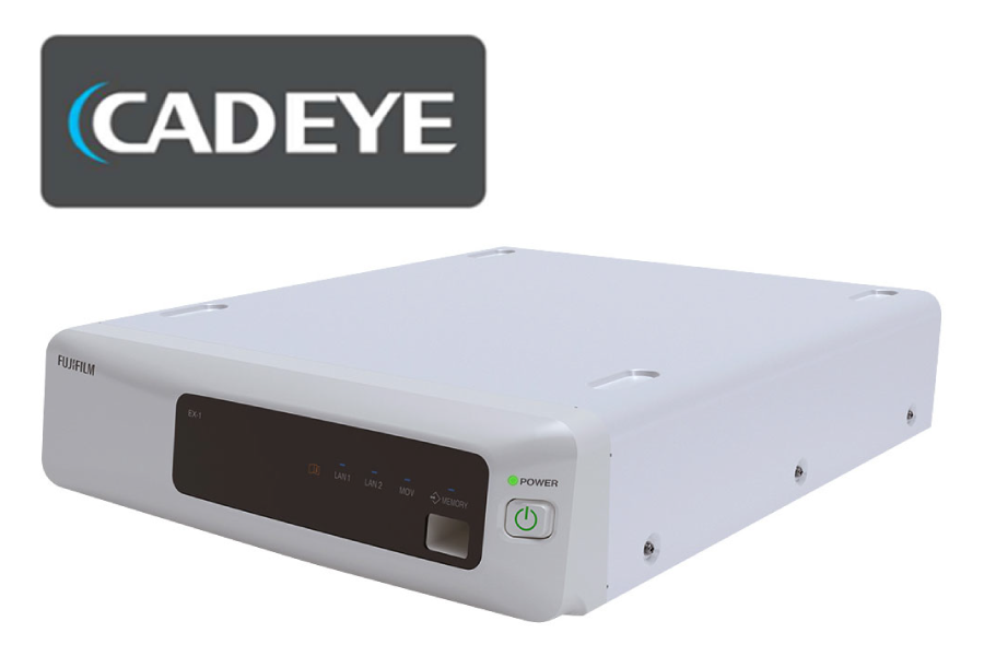 AIによる内視鏡診断支援機能「CADEYE™ （キャドアイ）」