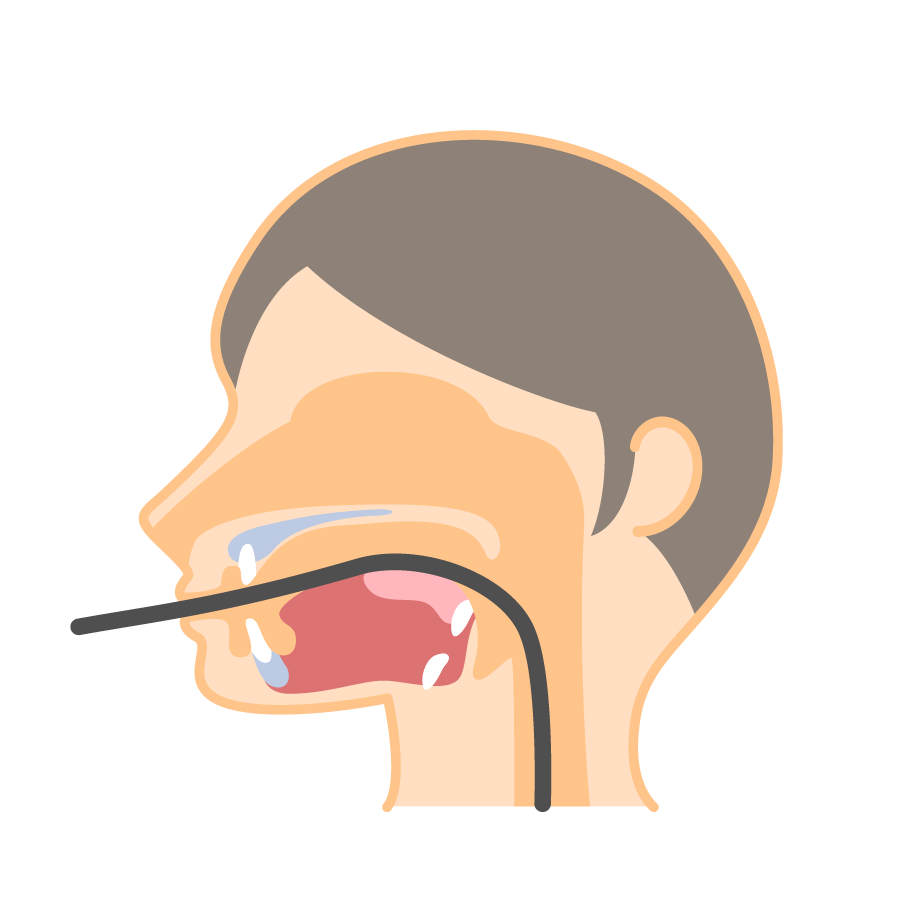 経口内視鏡のイメージ