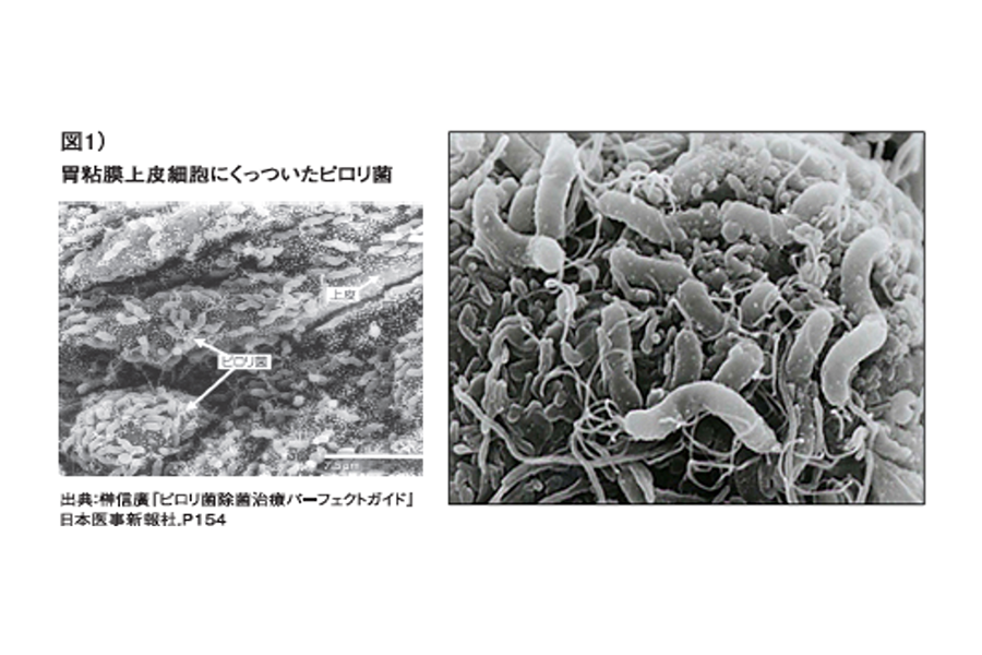 ピロリ菌