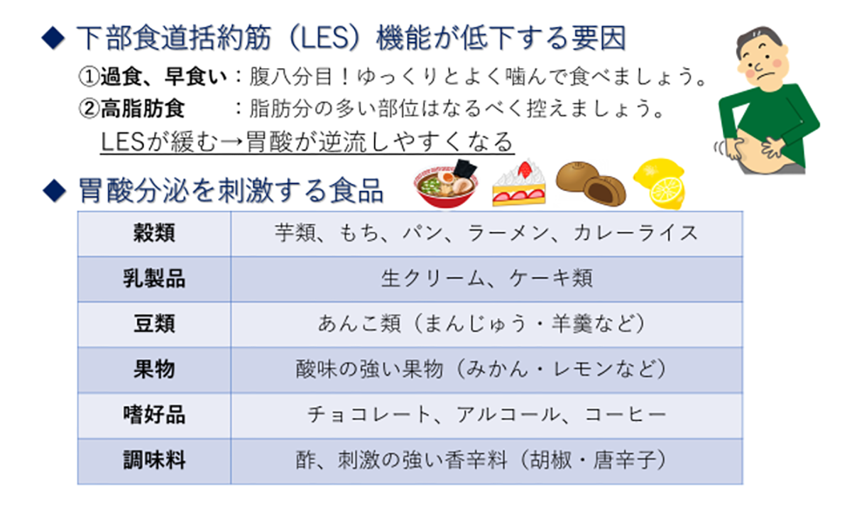 下部食道括約筋(LES)機能が低下する要因と胃酸分泌を刺激する食品